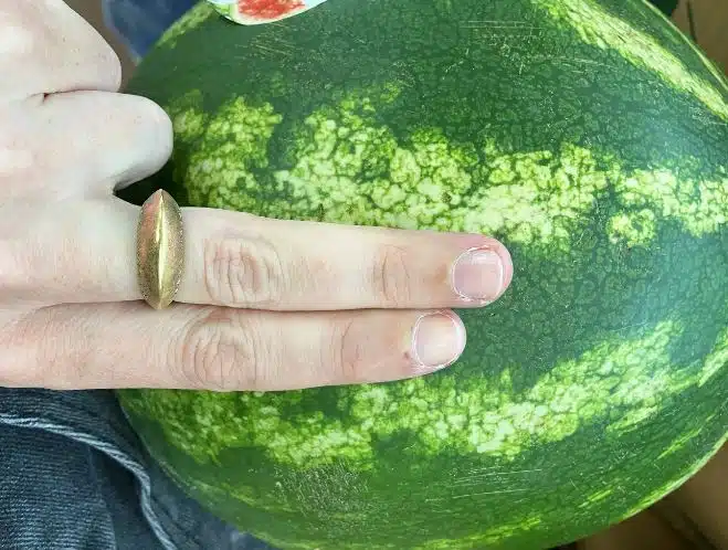 Vesimelonissa piilee yllättävä vaara – vahinkoja sattuu vuosittain myös Suomessa