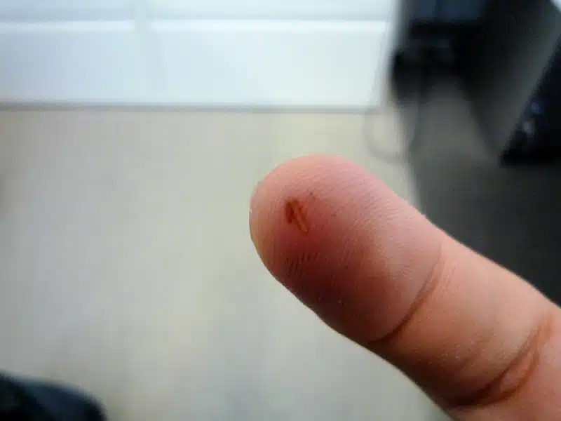 Näin pääset eroon tikusta helposti – apu löytyy jokaisen keittiöstä