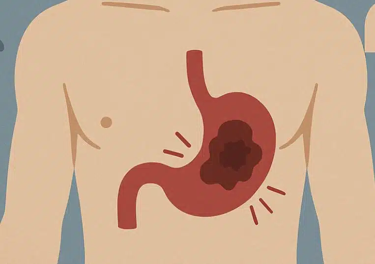 Mahasyöpä: ethän jätä huomioimatta tätä varoitusmerkkiä