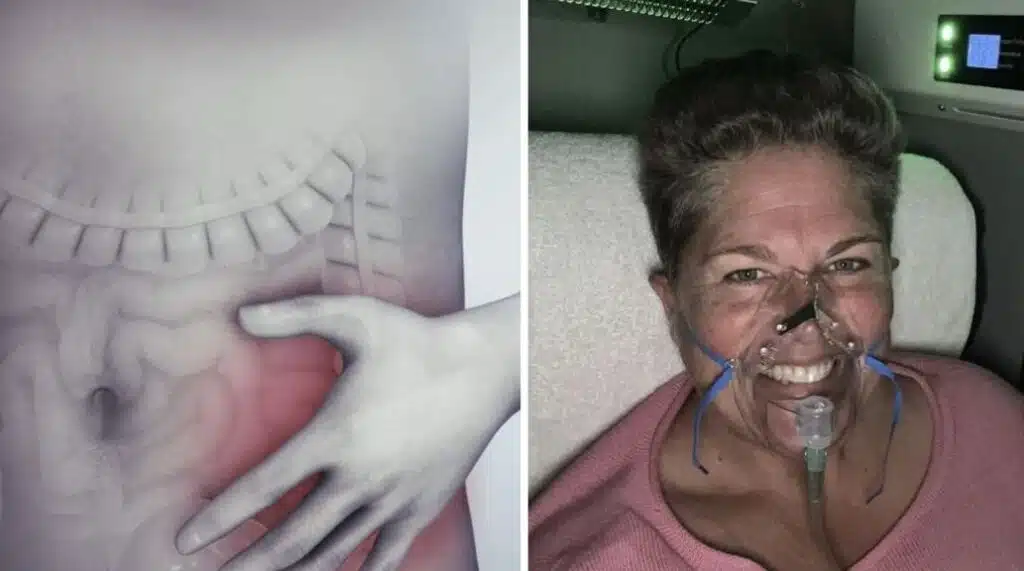 Perheenäiti varoittaa sivuutetusta oireesta, joka kätki suolistosyövän Perheenäiti varoittaa sivuutetusta oireesta, joka kätki suolistosyövän