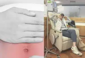 Vatsakipu olikin syöpä – lääkärit sivuttivat naisen oireet täysin